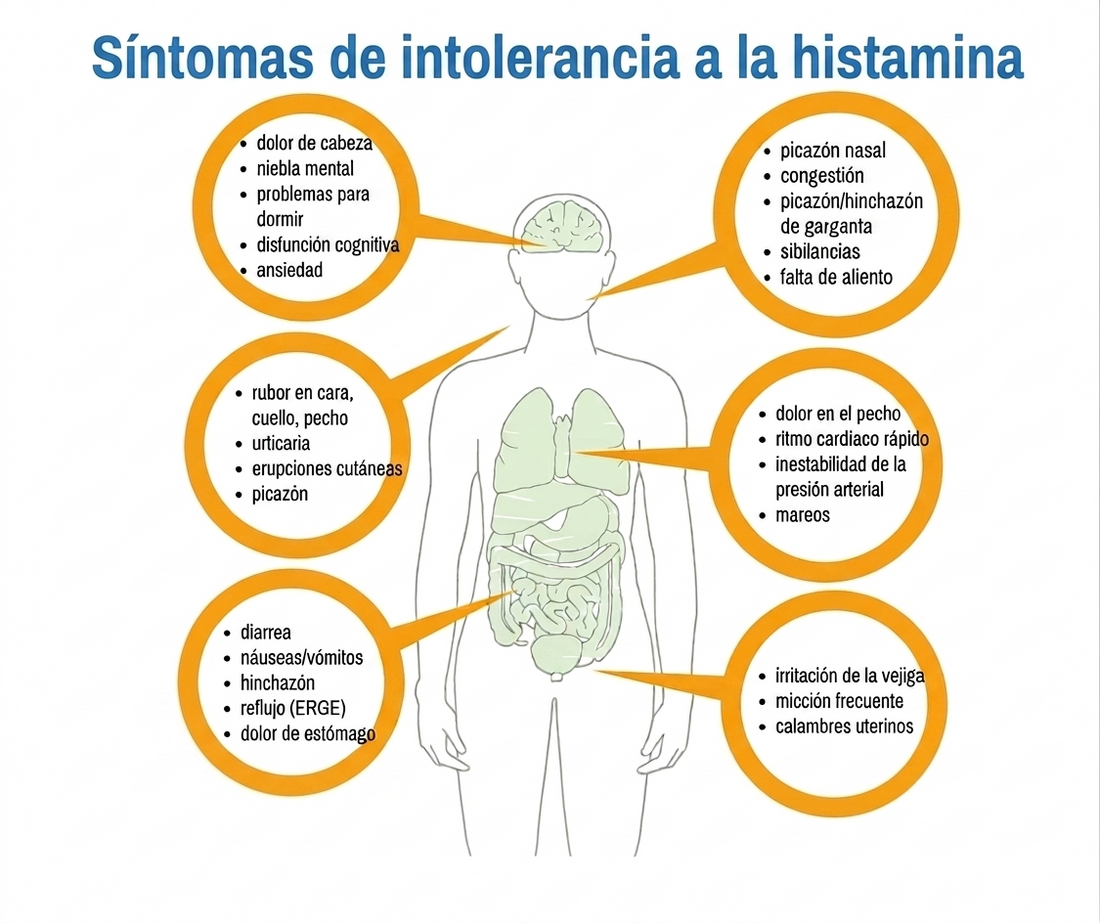 INTOLERANCIA A LA HISTAMINA