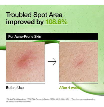 Anua Azelaic Acid 10 Hyaluron Redness Soothing Serum 30ml