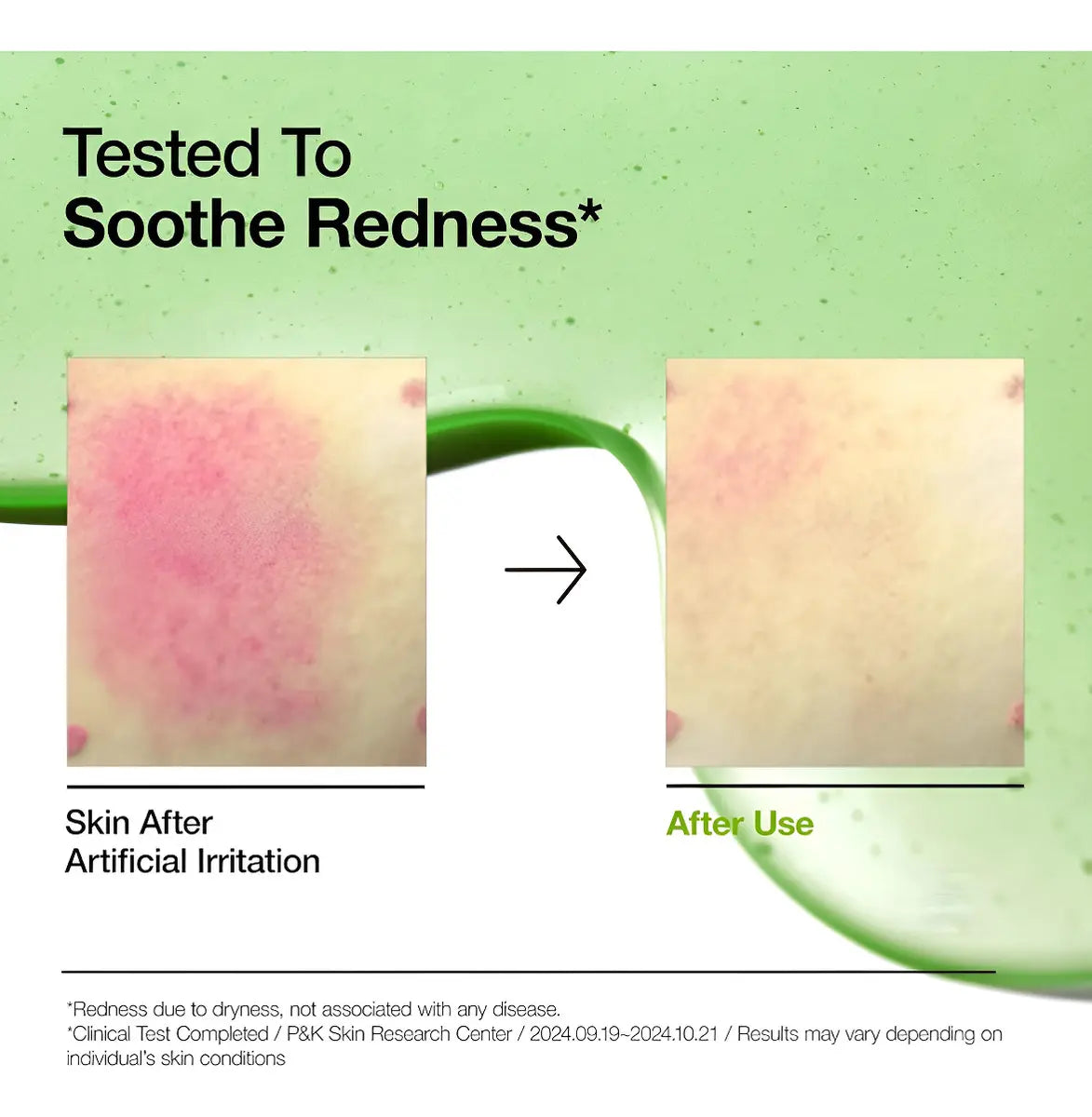 Anua Azelaic Acid 10 Hyaluron Redness Soothing Serum 30ml